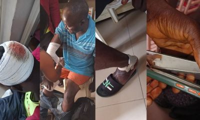 Maimed and hospitalised security officers of Penthouse Estate III in Lugbe, Abuja