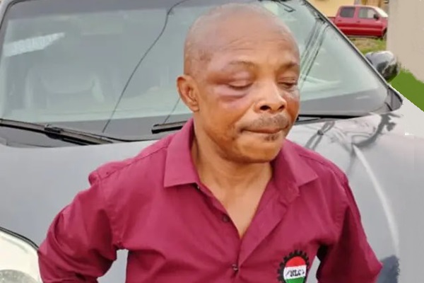 Battered Nigeria Labour Congress (NLC) President, Comrade Joe Ajaero