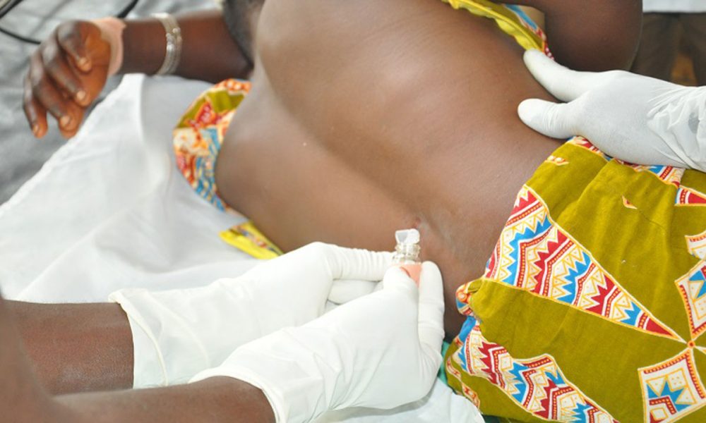 A patient down with Cerebro-Spinal-Meningitis