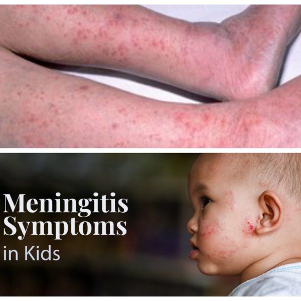Kebbi varsity officials under fire as meningitis claims six student