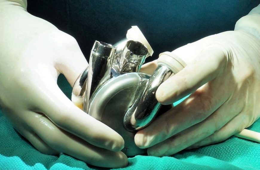 Man with Artificial Heart Lives 100+ Days at Home