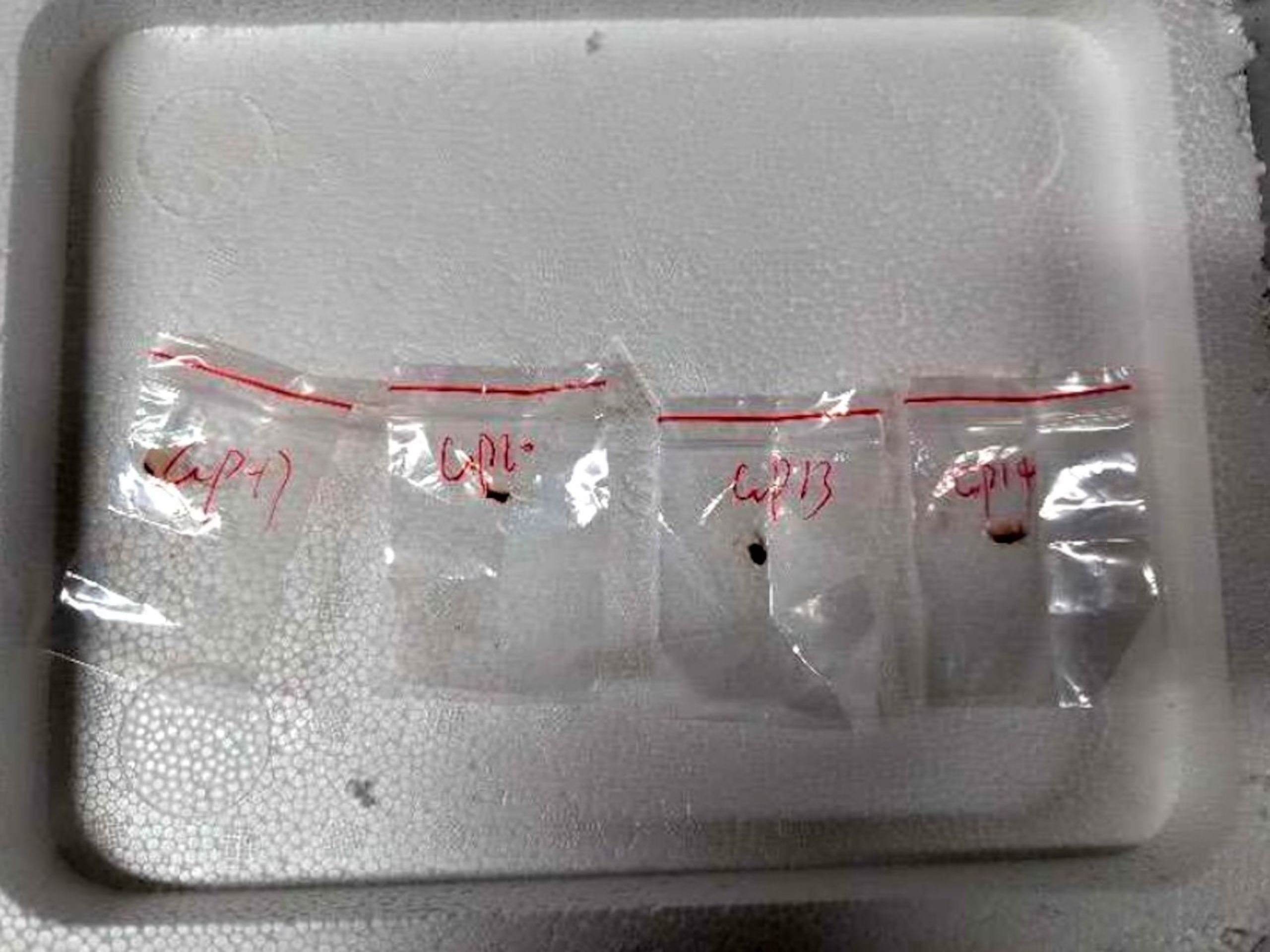 US government arrests Chinese nationals for smuggling dangerous bio pathogen into the country