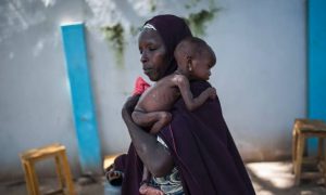 Malnourished child with her mother.