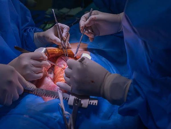 World Stunned as Doctors Revive Dead Baby Heart in Landmark Surgery