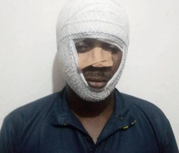Brutalised Edo activist demands justice after alleged vigilante attack