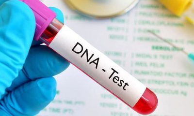 DNA
